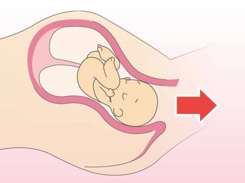 分娩,自然分娩,顺产,生孩子,Childbirth, Natural delivery, Vaginal delivery, Giving birth