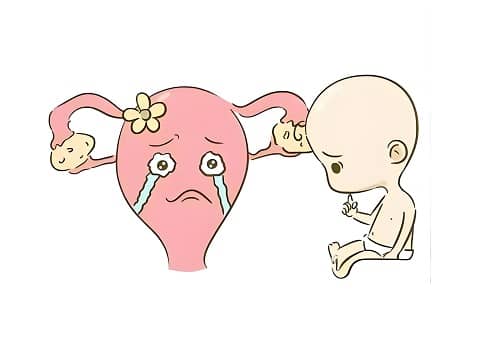 复发性流产预防,Prevention of Recurrent Miscarriage